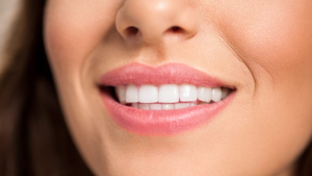 Transform Your Smile: Comparing Teeth Whitening and Veneers